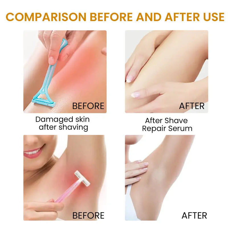 Bikini Hair Serum for Irritation Relief & Smooth Skin